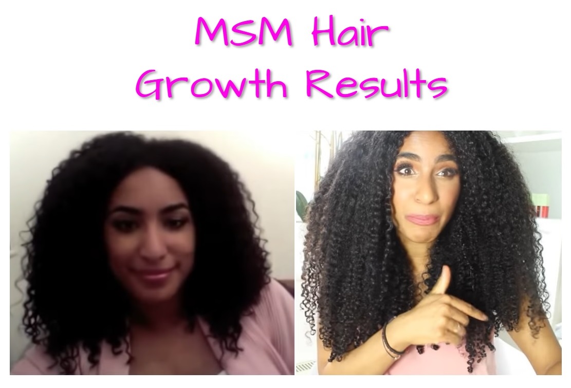 msm-hair-growth-before-and-after-pictures